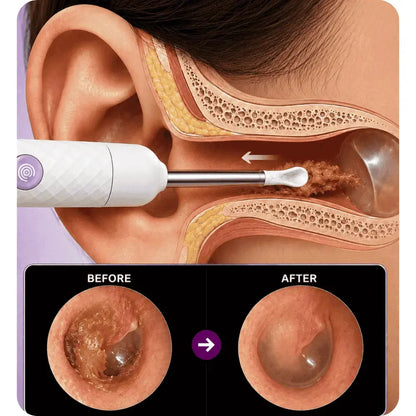 Smart Ear Cleaner with Camera deener.store
